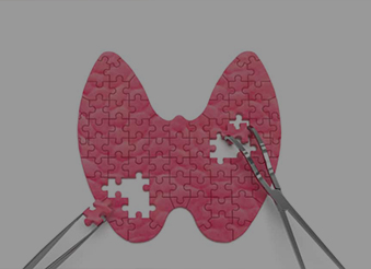 Захворювання<br/>щитовидної залози::Хірургічне лікування щитоподібної залози