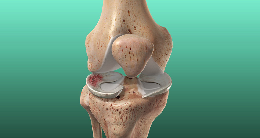 meniscus.jpg