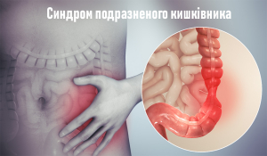 СПК. Що таке синдром подразненого кишківника. Як його діагностувати та лікувати.