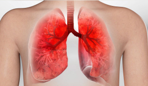 Лікування  бронхіту в Івано-Франківську