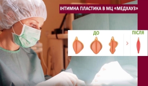 Інтимна пластика в МЦ «МЕДХАУЗ»