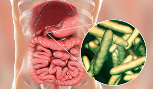 Симптоми та лікування дуоденіту в Івано-Франківську