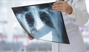 Лікар Пульмонолог . Які захворювання лікує та коли варто звернутись до спеціаліста?