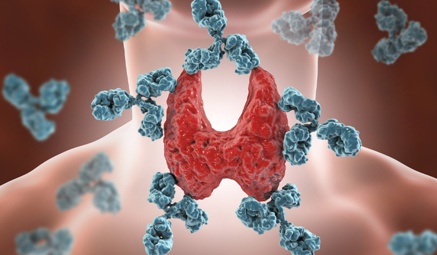 Аутоімунний тиреоїдит