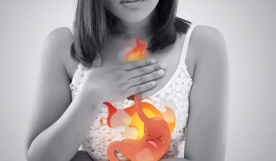 Гастроезофагальна рефлюксна хвороба (ГЕРХ)