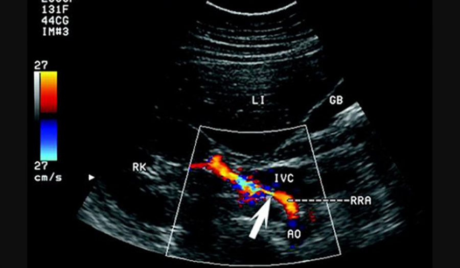 Доплерографія судин в МЦ «МЕДХАУЗ»