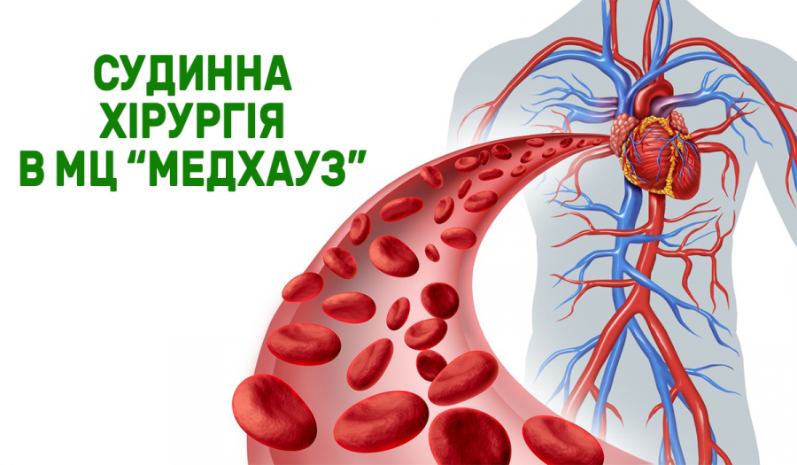 Судинна хірургія в МЦ «МЕДХАУЗ»