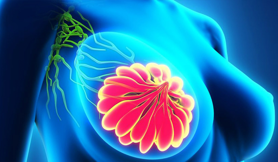 Важливо про рак молочної залози!