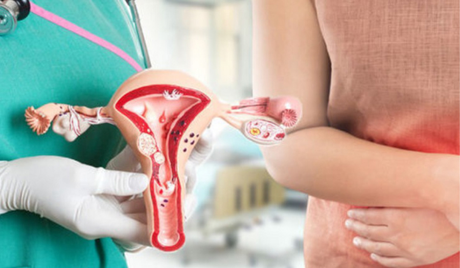 Дисплазія шийки матки: лікування та діагностика.