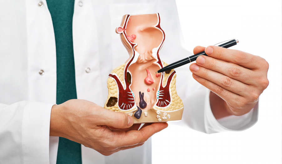 Гемороїдектомія у Івано-Франківську