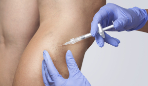 Склеротерапія: Ефективний та безболісний метод лікування варикозу в Івано-Франківську