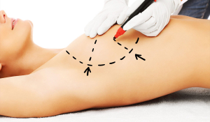 Мамопластика (пластика грудей) у Івано-Франківську