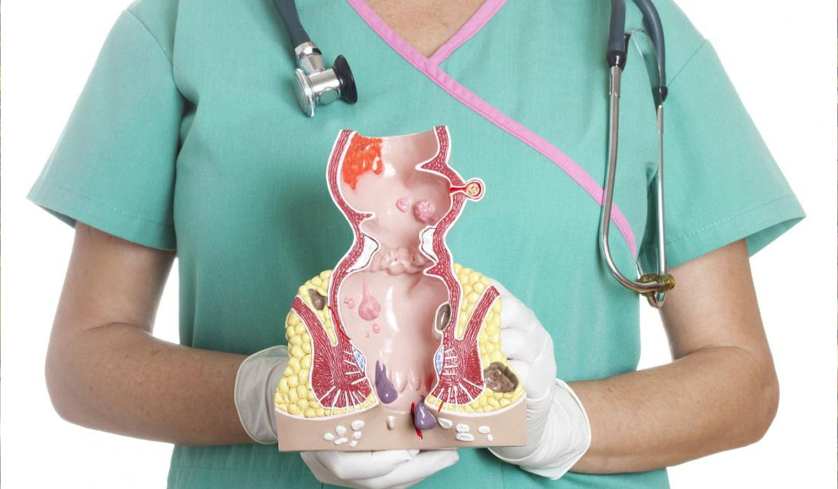 Поширені міфи про проктологічні захворювання: Правда і міфи